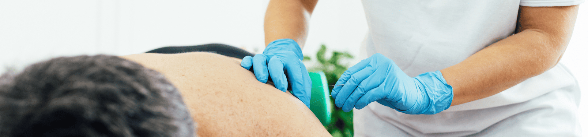 Dry Needling